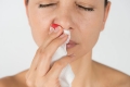 9 biện pháp khắc phục hiệu quả tại nhà để ngăn chặn chảy máu mũi
